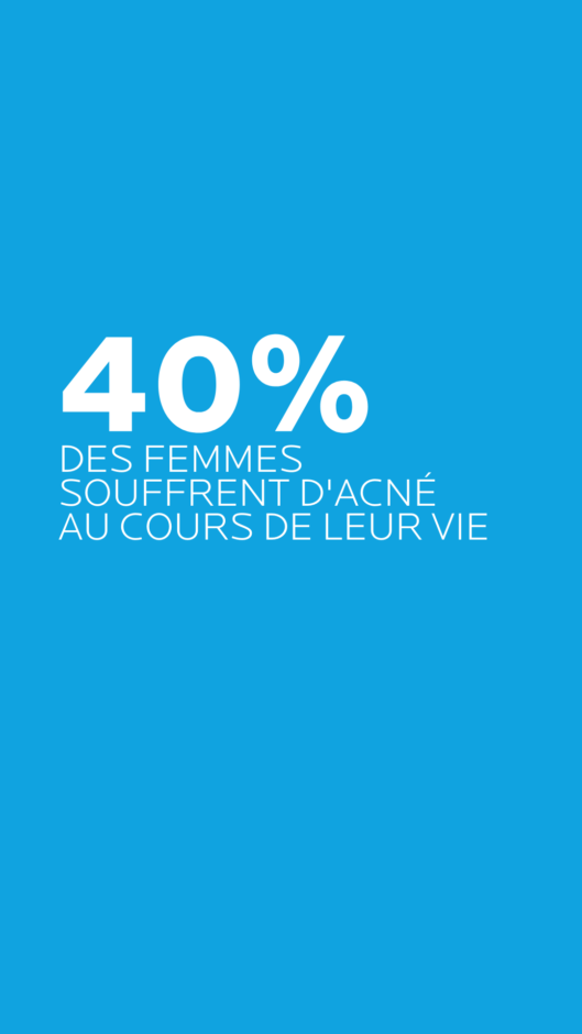 acné touche 40% femmes adulte adolescente